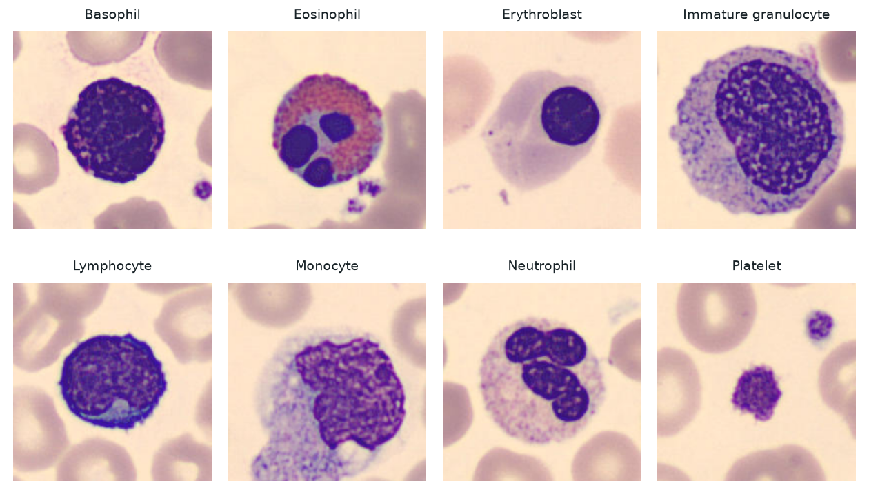 Eight labeled BloodMNIST training images: basophil, eosinophil, erythroblast, immature granulocyte, lymphocyte, monocyte, neutrophil, and platelet.